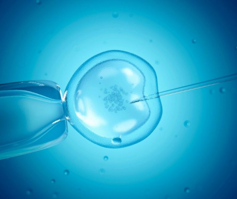 sztuczne zapłodnienie